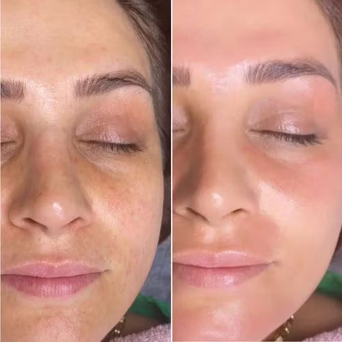 Caja De Lujo Vitamina C Bioaqua