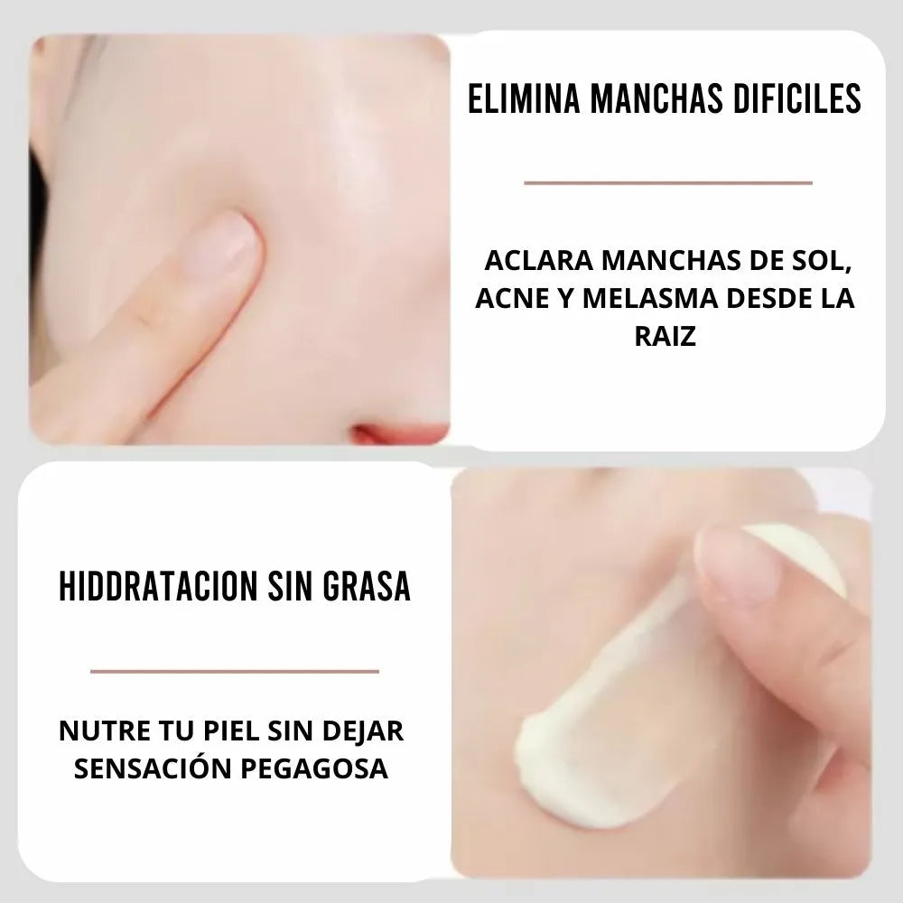 🔥 LLeva 3 Arbutin White® + 1 Elixir Antiedad de regalo! Dile adiós a las manchas y al acné revela tu verdadera piel 💖🔥