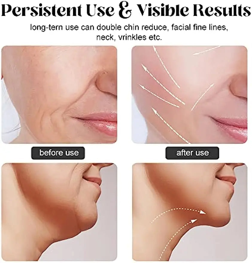 Masajeador Antiarrugas Y Rodillo