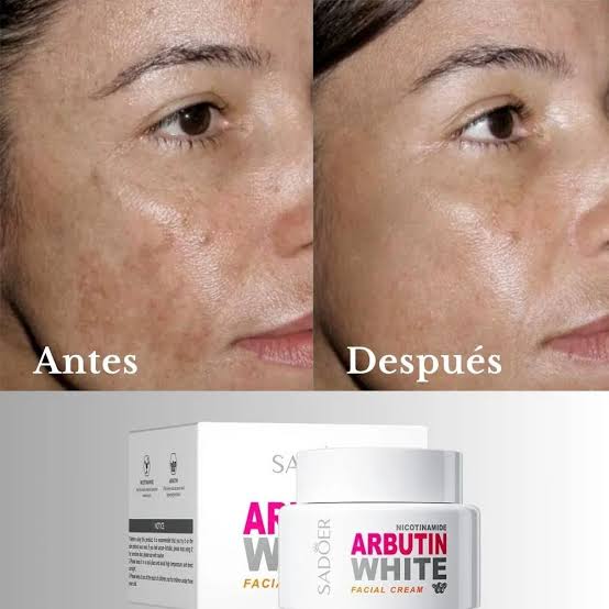 🔥 LLeva 3 Arbutin White® + 1 Elixir Antiedad de regalo! Dile adiós a las manchas y al acné revela tu verdadera piel 💖🔥
