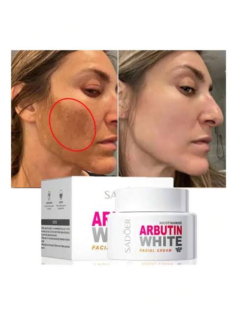 🔥 LLeva 3 Arbutin White® + 1 Elixir Antiedad de regalo! Dile adiós a las manchas y al acné revela tu verdadera piel 💖🔥